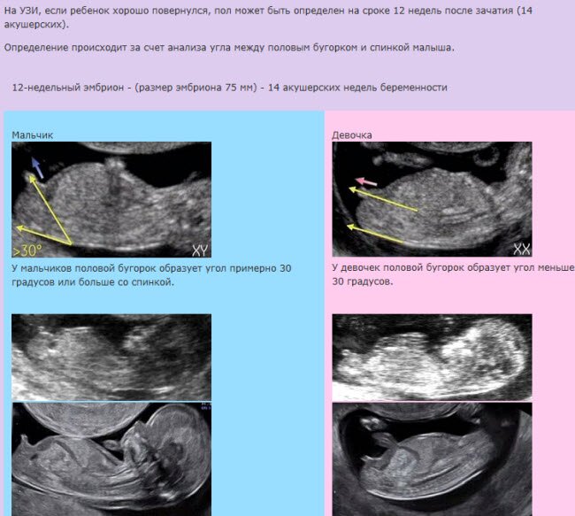 16 Недель Пол Ребенка Фото
