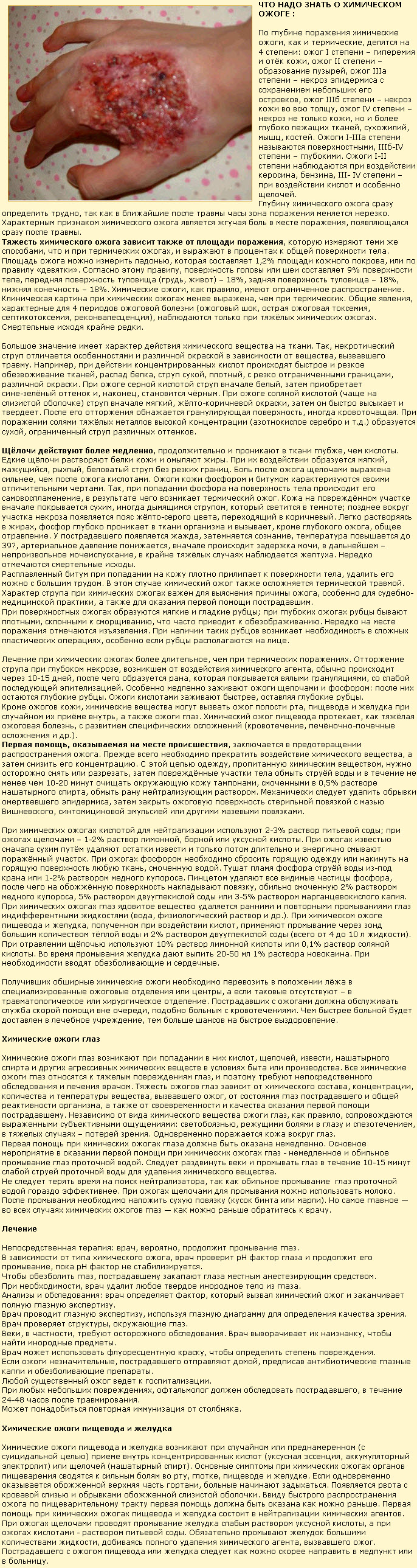 диета ларисы долиной скачать бесплатно