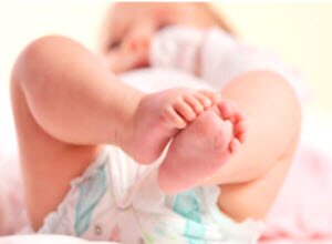 Изображение - Массаж новорожденным суставы displaziya-tazobedrennogo-sustava-foto
